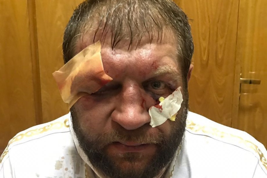 Александр Емельяненко показал фото из больницы, Хабиб поблагодарил Трампа